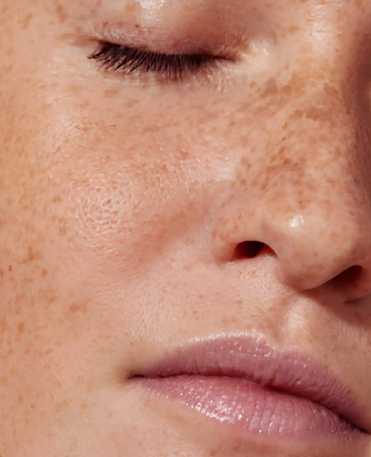 Skincare after microneedling, peels and injectables