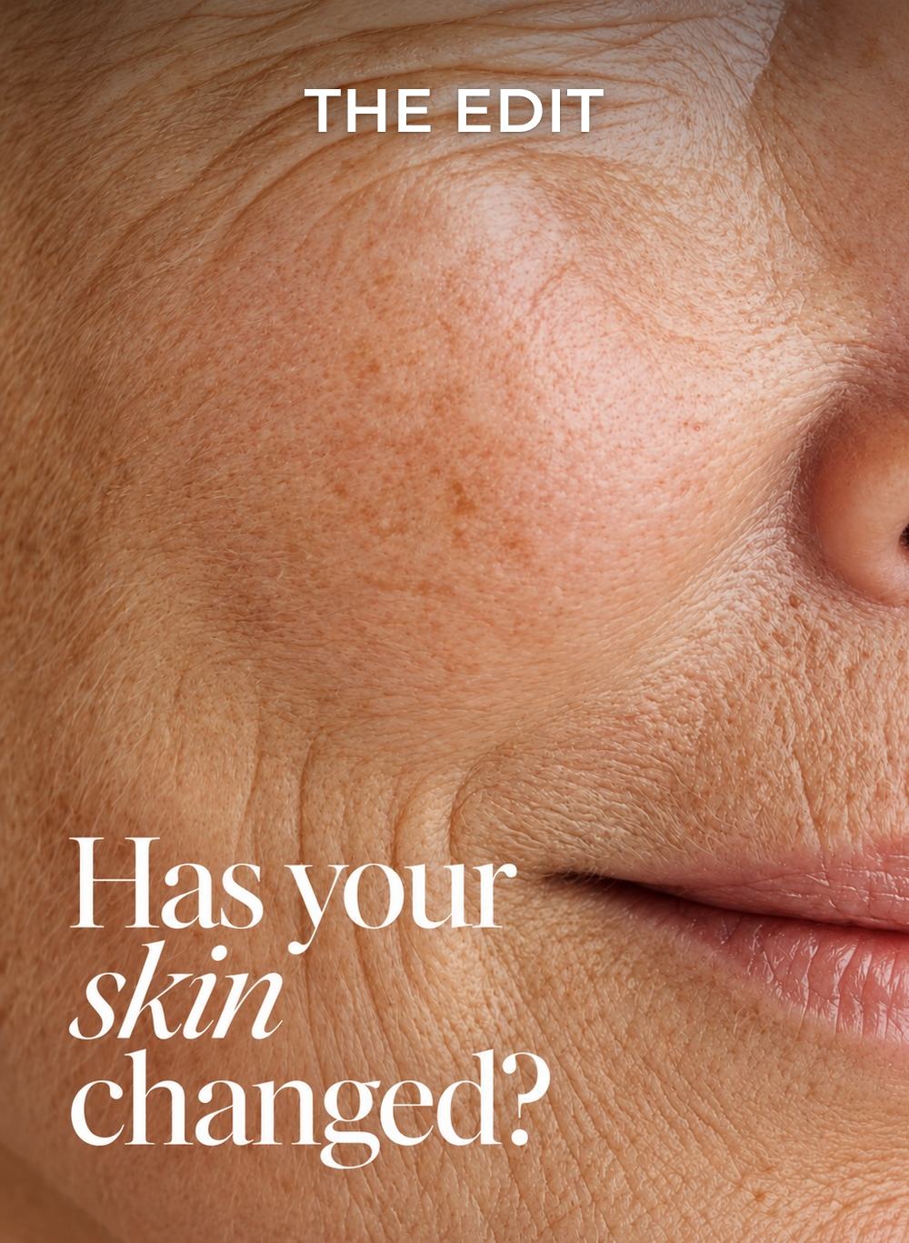 Is your skin becoming drier?